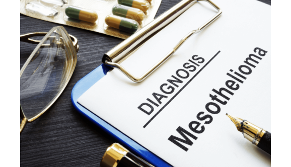 Mesothelioma diagnosis