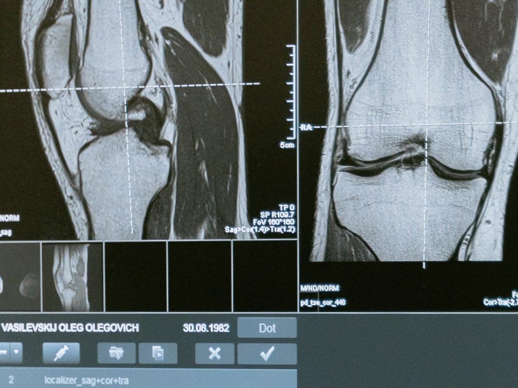 Medical Device X Ray